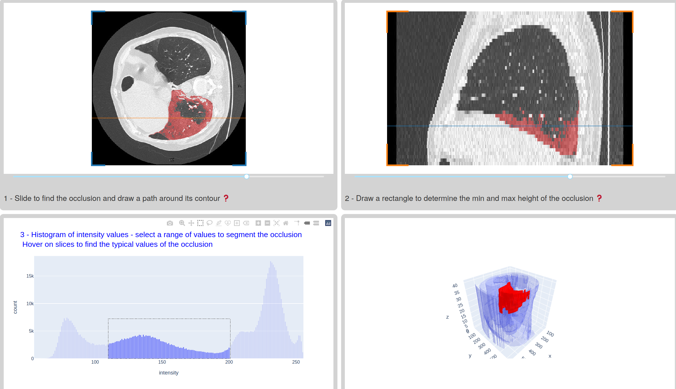 Screenshot of Covid-19 computed tomography app