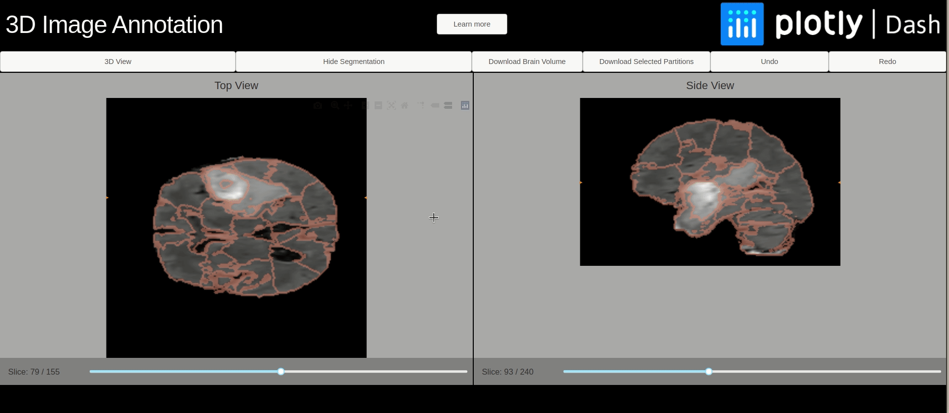 short animation showing some functions of a superpixel app